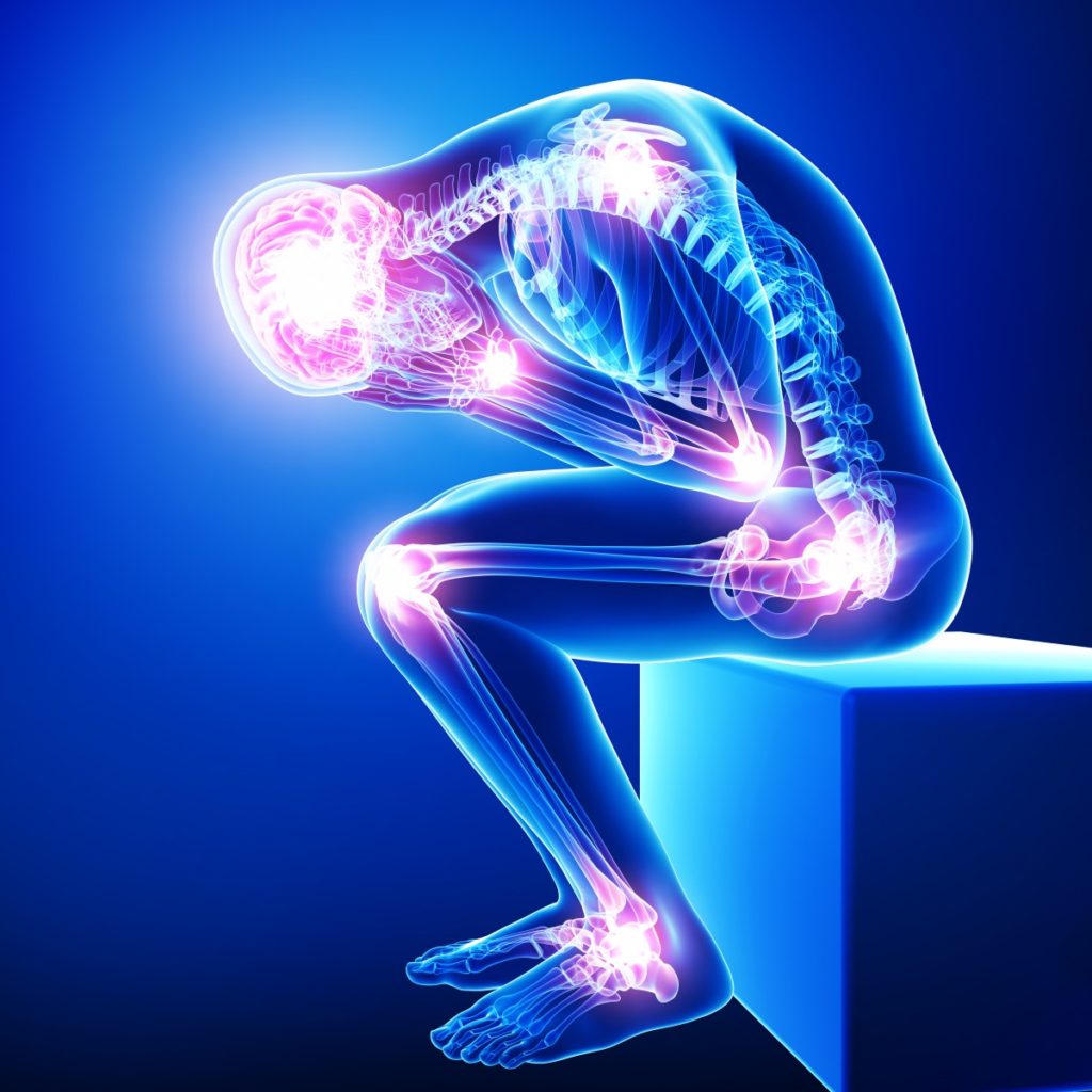 Link to What Is Fibromyalgia